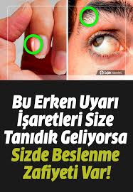 Bu Erken Uyari Isaretleri Tanidik Geliyorsa Sizde Beslenme Zafiyeti Var Video Beslenme Saglik Ipuclari Saglik