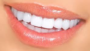 Teeth Whitening in Langley, BC | Novacare Dental