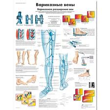 Varicose Veins Chart