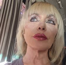 מחקר ישראלי: התסמין שנשאר חצי שנה אחר ההדבקה > bit.ly/3mG8Cuj צילום: מרים  אלסטר, פלאש 90