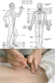 Pin On Chiropractic