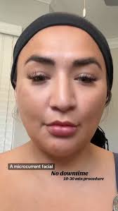 🤩 A microcurrent facial uses electrical currents to stimulate facial  muscles and promote cellular activity, aiming to lift, tighten, and firm 🥳  , the skin, reduce sagging, and improve contours for a ...
