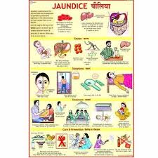 Jaundice Charts