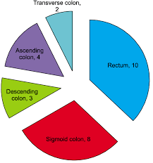 Image result for Primary Tumor Localization
