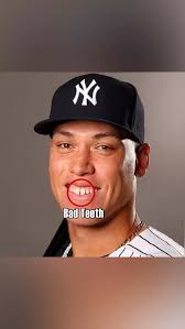 Big Dumper mogs Aaron Fudge