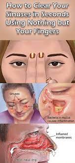 How To Clear Your Sinuses In Seconds Using Nothing But Your Fingers Healthy Tips Sinusitis Sinus Remedies Health Remedies