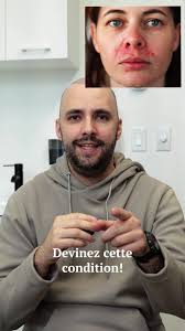 Dermatologue Ain Benian