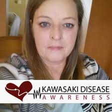 Does anyone have a good deer tenderloin recipe? I may use oven or smoke it.