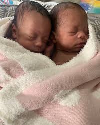 Latoya Barrett made a courageous decision to change her life after battling  weight issues for years. Following her bariatric surgery with Dr. Colston  Edgerton at Novant Health New Hanover Regional Medical Center,