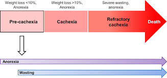 Image result for Cachexia in Cancer