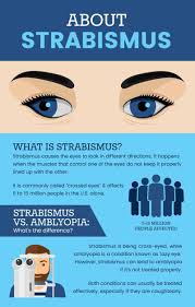 Strabismus Natural Ways To Help Resolve Crossed Eyes Dr Axe In 2020 Eye Health Eye Exercises Strabismus Exercises