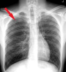 Image result for Pleiotaxis