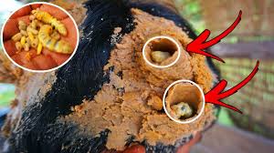 I have dandruff, my hair is very thick, my hair falls out more and more is blood under dandruff flakes normal? Download Dr Huge Flake Mp4 Mp3 3gp Naijagreenmovies Fzmovies Netnaija
