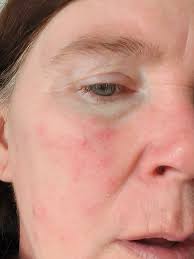 How has anyone made the change over from working to being in long term  disability or regular disability. I carry the insurance for my family, and  need to stop working and I