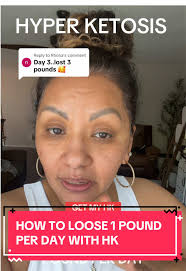 Replying to @Rhona Hyper ketosis