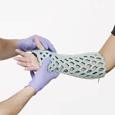 Image result for Short Arm Cast