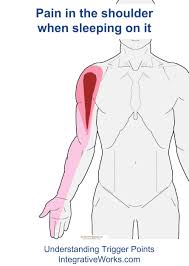 How would you explain the cause of your shoulder pain? Pin On Exercise