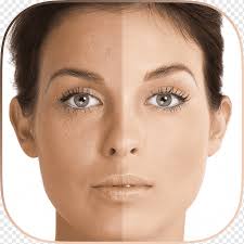 Skin attains an uneven tone due to an imbalance in melanin production resulting in pigmentation or dark i have lately faced acne due to some product allergy and was facing the issue of pigmentation post acne. Má»¥n Skin Cong Ty Má»¹ Pháº©m Ä'Äƒng DÆ°Æ¡ng Lazada Group Ngá»c Trai Cream Acne Skin Care Png Pngwing