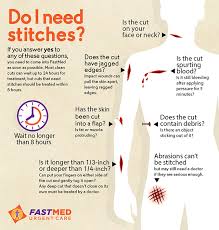 The cut occurred as a result of an animal or human bite, or was punctured by any other object that may cause infection. Do I Need Stitches Infographic Explanation Fastmed