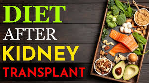 Diet Plan After Kidney Transplant Diet For Kidney Transplant Patients In 2020 Kidney Treatment Kidney Transplant Kidney Patient Diet