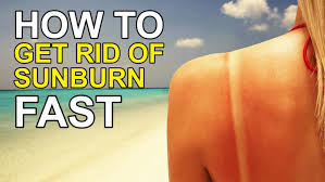 How to stop sunburn peeling. How To Stop Skin Peeling After Sunburn Hints And Tips To Avoid Treat And Heal Surrey Live