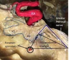 Erik trautmann / hearst connecticut media show. Intracranial Anatomical Triangles A Comprehensive Illustrated Review Abstract Europe Pmc