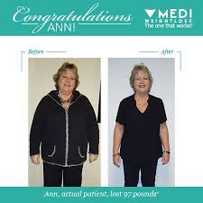 Pin On Before After