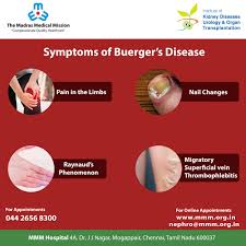 Pin On Buerger S
