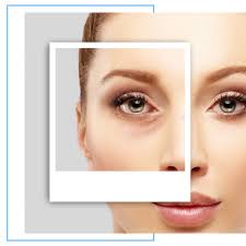 Blepharoplasty Services