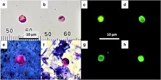 Ingestion of contaminated food and water containing oocyst. Multi Spatial Contamination Of Environmental Aquatic Matrices With Cryptosporidium A Climate Health And Regulatory Framework For The Philippines Springerlink