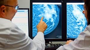 Medizin Welche Vorstufe Von Brustkrebs Ist Riskant Wissen Stuttgarter Zeitung
