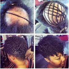 Stylist Feature This Transformation Done By Atlantastylist Startakihair Is Simply Amazing Natural Hair Styles Short Natural Hair Styles Alopecia Hairstyles