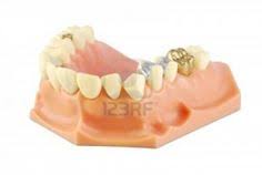 Check spelling or type a new query. 48 Sell Dental Gold Ideas Gold Buyer Dental Gold