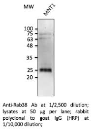 Anti Rab38 Antibody Goat Rab38 Polyclonal Antibody Np_071732 1