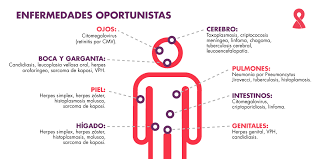 El diccionario panhispánico de dudas se propone servir de instrumento eficaz la norma culta. Que Es El Vih Y Como Se Detecta Fundacion Huesped