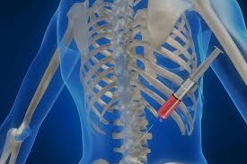 Липома и атерома кожи — две распространенные разновидности доброкачественных новообразований. Shishka Mezhdu Rebrami Vozmozhnye Prichiny Metody Diagnostiki I Terapiya