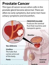If the cancer has spread beyond the prostate gland, men may experience swelling in the lower body, back, hip or bone pain, abnormal bowel or urinary habits or unexplained weight loss. Prostate Enlargement Benin Dr Denish Health Moments Facebook