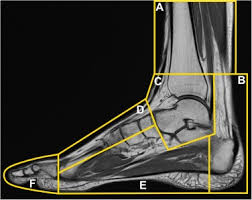 ► shoulder ► elbow ► wrist ► finger ► thumb. Mri Of Complex Regional Pain Syndrome In The Foot European Journal Of Radiology