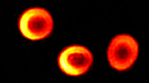 Find more images #cells at work! Red Blood Cell Rbc Lynceetec