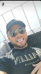 Marietta zrobiła nos, Chris też poprawia urodę. Na zabieg poleciał aż do  Turcji