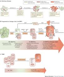 Treatment of metastatic cancer focuses on slowing the spread of the cancer and relieving symptoms, such as bone pain. Strategies To Avoid Treatment Induced Lineage Crisis In Advanced Prostate Cancer Nature Reviews Clinical Oncology