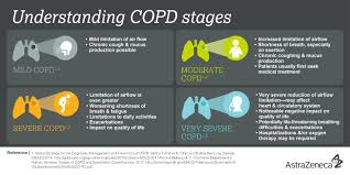 Image result for COPD Staging