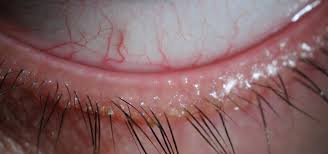 Image result for Blepharis transvaalensis