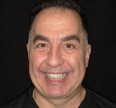 DID YOU KNOW THAT...... 💡 Dr. Hans Sperling is a second generation  Dentist. 🦷 He worked very closely with his father, Dr. Thomas Sperling, a  world class Orthodontist and professor, who was