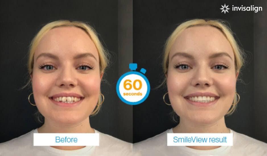 Digital Smile Simulation