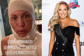 Real Housewives' Braunwyn Windham-Burke, 42, wrapped in bandages after  'facelift'