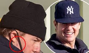 Tom Cruise displays mystery mark