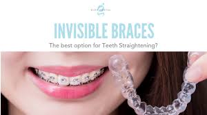 It can take some getting used to the way braces look, and many people feel self conscious, especially when they first get braces. Invisible Braces The Best Option For Teeth Straightening Glen Dental