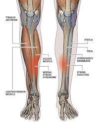 Your doctor may refer to the. Medial Tibial Stress Syndrome Shin Splints Zion Physical Therapy