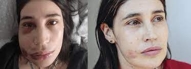 El pasado viernes 18 de octubre, en medio de los incidentes en santiago, la intérprete. Pido Justicia Saber Quien Me Disparo Y Por Que Maria Paz Grandjean Hablo Tras Ser Atacada Por Carabineros Fotech Cl